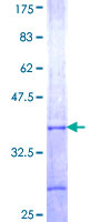 ARR3 / Cone Arrestin Protein - 12.5% SDS-PAGE Stained with Coomassie Blue.