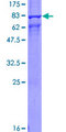 ARRB1 / Beta Arrestin 1 Protein - 12.5% SDS-PAGE of human ARRB1 stained with Coomassie Blue