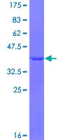 ARRB1 / Beta Arrestin 1 Protein - 12.5% SDS-PAGE Stained with Coomassie Blue.