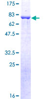 ARRB2 / Beta Arrestin 2 Protein - 12.5% SDS-PAGE of human ARRB2 stained with Coomassie Blue
