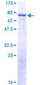 ARRB2 / Beta Arrestin 2 Protein - 12.5% SDS-PAGE of human ARRB2 stained with Coomassie Blue