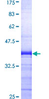 ARRB2 / Beta Arrestin 2 Protein - 12.5% SDS-PAGE Stained with Coomassie Blue.