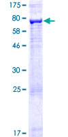 ARRDC1 Protein - 12.5% SDS-PAGE of human ARRDC1 stained with Coomassie Blue