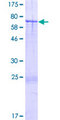 ARRDC2 Protein - 12.5% SDS-PAGE of human ARRDC2 stained with Coomassie Blue