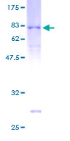 ARRDC3 Protein - 12.5% SDS-PAGE of human ARRDC3 stained with Coomassie Blue