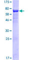 ARRDC4 Protein - 12.5% SDS-PAGE of human ARRDC4 stained with Coomassie Blue
