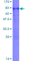 ARSA / Arylsulfatase A Protein - 12.5% SDS-PAGE of human ARSA stained with Coomassie Blue