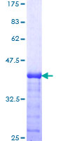 ARSA / Arylsulfatase A Protein - 12.5% SDS-PAGE Stained with Coomassie Blue.
