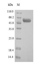 ARSB / Arylsulfatase B Protein - (Tris-Glycine gel) Discontinuous SDS-PAGE (reduced) with 5% enrichment gel and 15% separation gel.