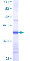 ARSB / Arylsulfatase B Protein - 12.5% SDS-PAGE Stained with Coomassie Blue.