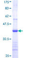 ARSB / Arylsulfatase B Protein - 12.5% SDS-PAGE Stained with Coomassie Blue.