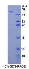 ARSB / Arylsulfatase B Protein - Recombinant Arylsulfatase B By SDS-PAGE