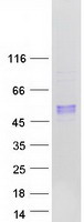 ARSB / Arylsulfatase B Protein - Purified recombinant protein ARSB was analyzed by SDS-PAGE gel and Coomassie Blue Staining