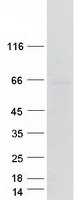 ARSD / Arylsulfatase D Protein - Purified recombinant protein ARSD was analyzed by SDS-PAGE gel and Coomassie Blue Staining