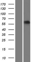 ARSE / Arylsulfatase E Protein - Western validation with an anti-DDK antibody * L: Control HEK293 lysate R: Over-expression lysate