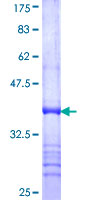 ARSE / Arylsulfatase E Protein - 12.5% SDS-PAGE Stained with Coomassie Blue.