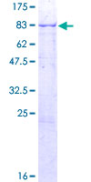 ARSF / Arylsulfatase F Protein - 12.5% SDS-PAGE of human ARSF stained with Coomassie Blue