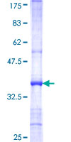 ARSF / Arylsulfatase F Protein - 12.5% SDS-PAGE Stained with Coomassie Blue.