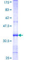 ARSF / Arylsulfatase F Protein - 12.5% SDS-PAGE Stained with Coomassie Blue.