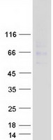 ARSG / Arylsulfatase G Protein - Purified recombinant protein ARSG was analyzed by SDS-PAGE gel and Coomassie Blue Staining