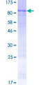 ARSH / Arylsulfatase H Protein - 12.5% SDS-PAGE of human ARSH stained with Coomassie Blue