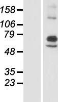 ARSI / Arylsulfatase I Protein - Western validation with an anti-DDK antibody * L: Control HEK293 lysate R: Over-expression lysate