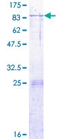 ARSK / Arylsulfatase K Protein - 12.5% SDS-PAGE of human ARSK stained with Coomassie Blue
