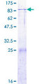 ARSK / Arylsulfatase K Protein - 12.5% SDS-PAGE of human ARSK stained with Coomassie Blue