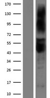 ART3 Protein - Western validation with an anti-DDK antibody * L: Control HEK293 lysate R: Over-expression lysate