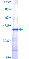 ART3 Protein - 12.5% SDS-PAGE Stained with Coomassie Blue.