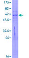ART4 Protein - 12.5% SDS-PAGE of human ART4 stained with Coomassie Blue