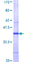 ART4 Protein - 12.5% SDS-PAGE Stained with Coomassie Blue.