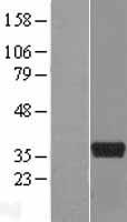 ART5 Protein - Western validation with an anti-DDK antibody * L: Control HEK293 lysate R: Over-expression lysate