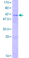 ART5 Protein - 12.5% SDS-PAGE of human ART5 stained with Coomassie Blue