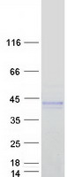 ART5 Protein - Purified recombinant protein ART5 was analyzed by SDS-PAGE gel and Coomassie Blue Staining