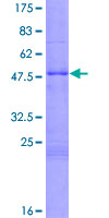 ARTN / Artemin Protein - 12.5% SDS-PAGE of human ARTN stained with Coomassie Blue