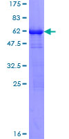 ARTS Protein - 12.5% SDS-PAGE of human PRPS1 stained with Coomassie Blue