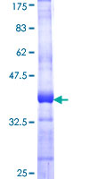 ARTS Protein - 12.5% SDS-PAGE Stained with Coomassie Blue.
