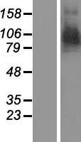 ARTS1 / ERAP1 Protein - Western validation with an anti-DDK antibody * L: Control HEK293 lysate R: Over-expression lysate