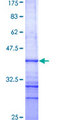 ARTS1 / ERAP1 Protein - 12.5% SDS-PAGE Stained with Coomassie Blue.