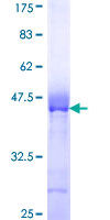 ARVCF Protein - 12.5% SDS-PAGE Stained with Coomassie Blue.