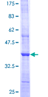 ARX Protein - 12.5% SDS-PAGE Stained with Coomassie Blue.