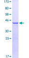 ARX Protein - 12.5% SDS-PAGE Stained with Coomassie Blue.