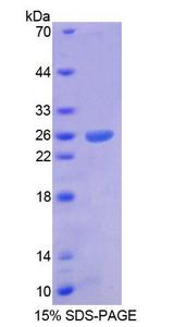 ARX Protein - Recombinant  Aristaless Related Homeobox Protein By SDS-PAGE