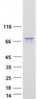 ARX Protein - Purified recombinant protein ARX was analyzed by SDS-PAGE gel and Coomassie Blue Staining