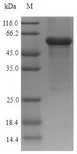 ASAH1 / Acid Ceramidase Protein - (Tris-Glycine gel) Discontinuous SDS-PAGE (reduced) with 5% enrichment gel and 15% separation gel.
