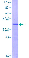 ASAH1 / Acid Ceramidase Protein - 12.5% SDS-PAGE Stained with Coomassie Blue.