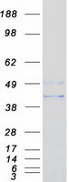 ASAH1 / Acid Ceramidase Protein - Purified recombinant protein ASAH1 was analyzed by SDS-PAGE gel and Coomassie Blue Staining