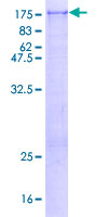 ASAP2 / DDEF2 Protein - 12.5% SDS-PAGE of human DDEF2 stained with Coomassie Blue