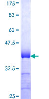 ASAP2 / DDEF2 Protein - 12.5% SDS-PAGE Stained with Coomassie Blue.